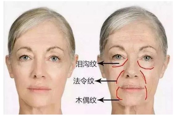 防止脸部肌肉松弛_如何按摩脸部防止衰老_