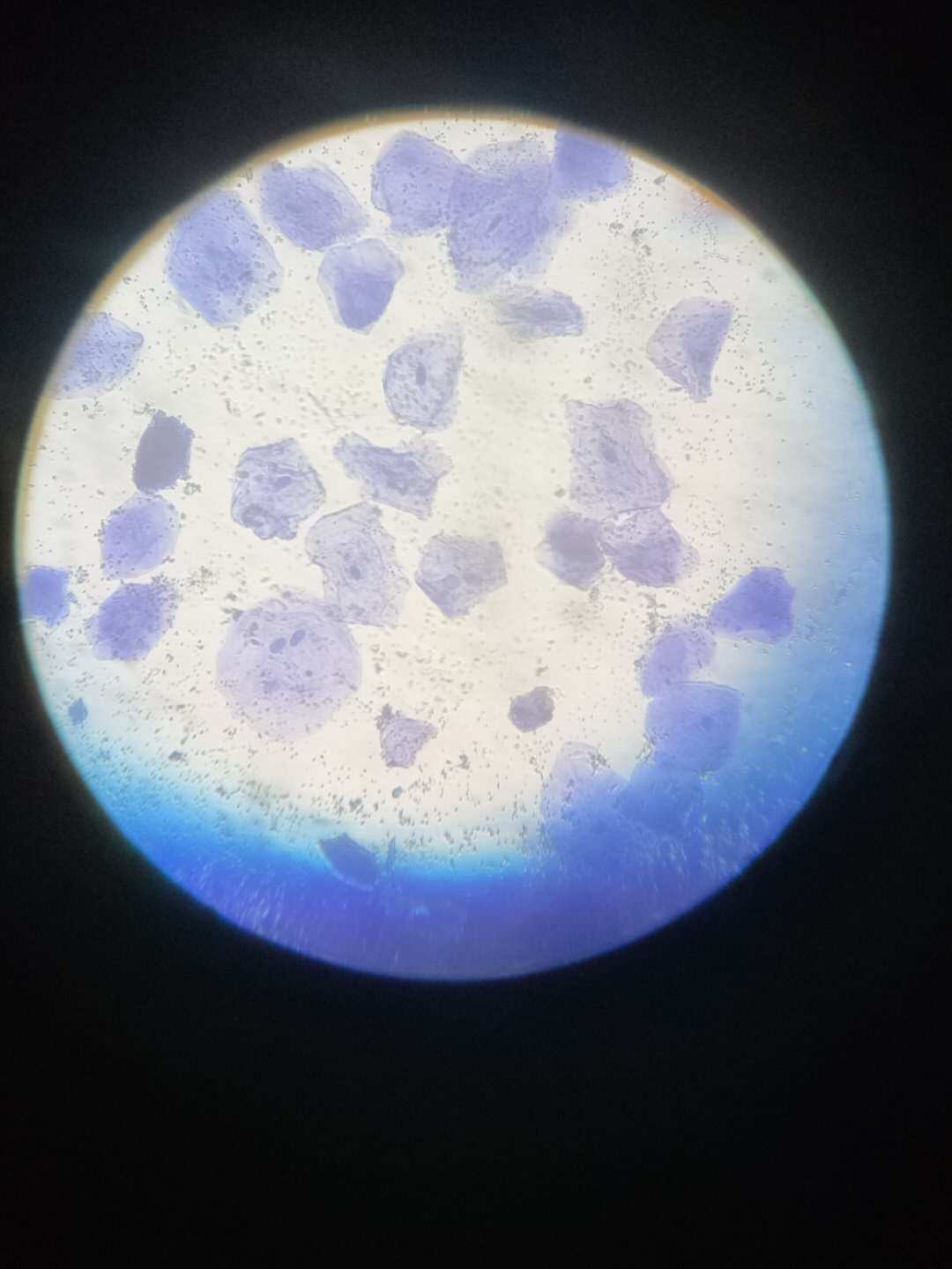 _维生素有没有必要买贵的_维生素建议吃吗