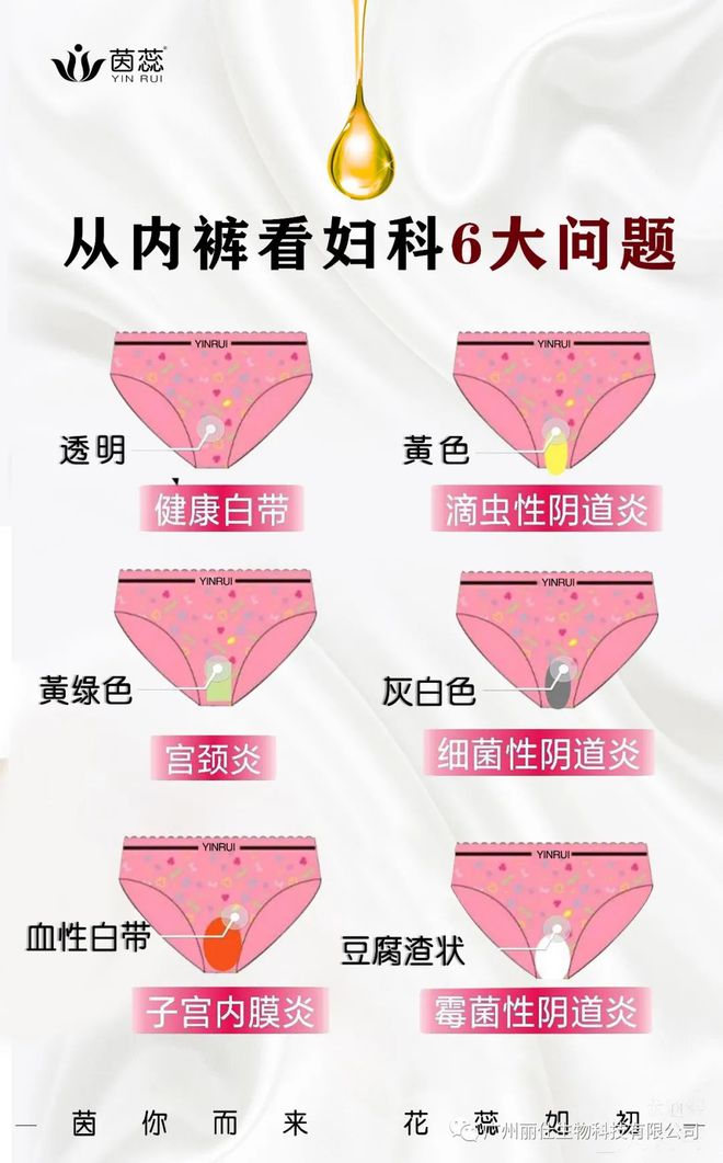 得了妇科病男朋友不负责__妇科病男得朋友没会传染吗