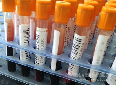 实验室检查是确定呼吸道疾病病原体准确的方法