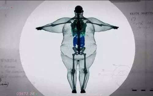 胖子健康问题_没有健康的胖子_