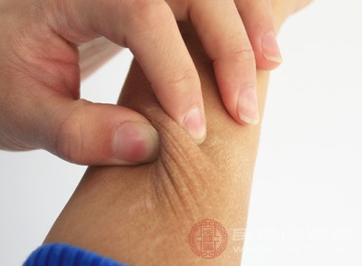 屁股潮湿、温暖的环境非常有利于细菌、真菌等微生物的生长繁殖