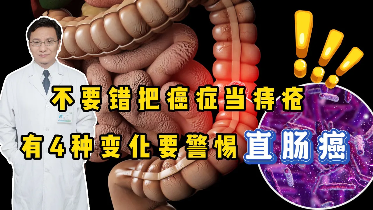 _早期结肠癌怎么发现_结肠早癌是不是癌症