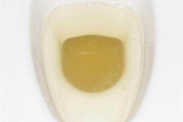 肾好的人喝水后排尿会慢一点吗_喝水就尿是肾炎吗_