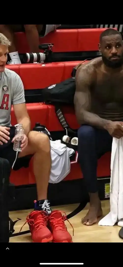 科梅内尔憩室要切除吗__科尔什么