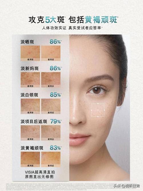 美白淡斑精华哪个品牌好__淡斑美白精华哪个好用